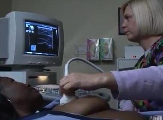 American Ladies having a Mammogram (and other Breast Exams)