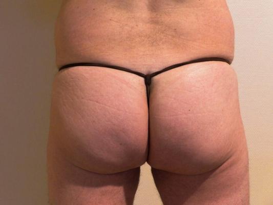 Tanga frontal abierta