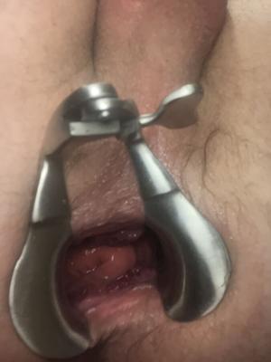 Speculum Play Last Night