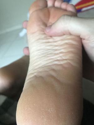 GF sexy feet dry and smelly comment