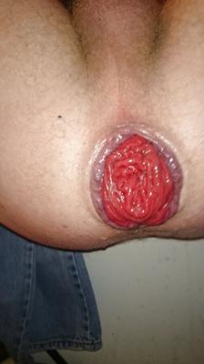 More of my loose gaping fist hole