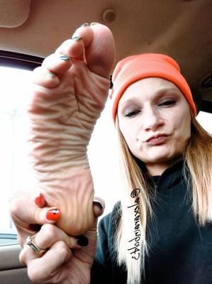 deep milky white wrinkled soles