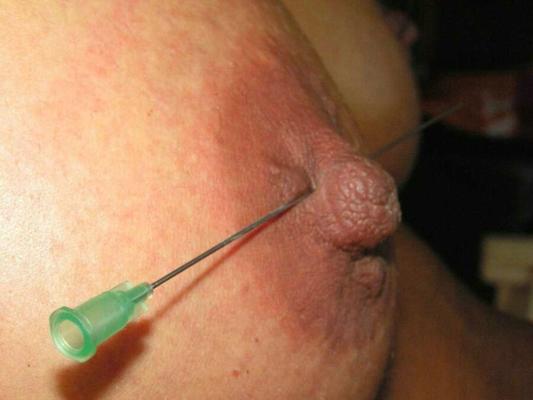 Needles in Nipples