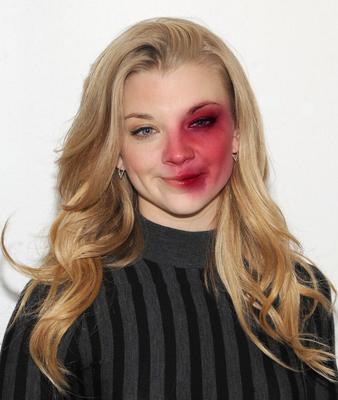 Natalie Dormer Bruise Fakes by KK