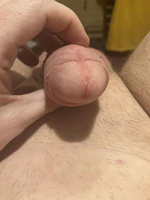 Foreskin Friday