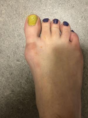 Esmalte de color aleatorio en mis pies sucios