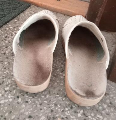 Stinky stained shoes