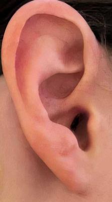 A girl's ear