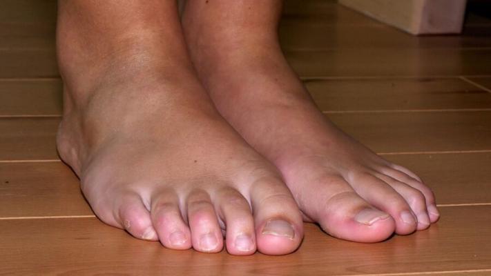 PIEDS :/