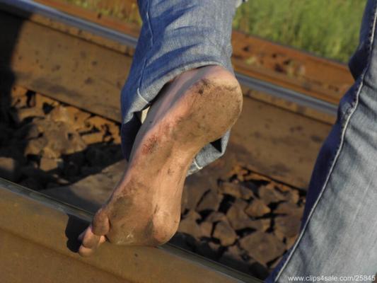 Railway dirty feet