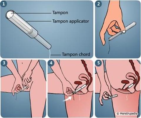 Tampon