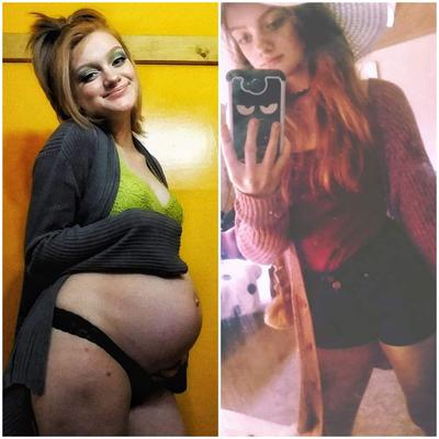 Adolescentes embarazadas: antes y después de los 5 años