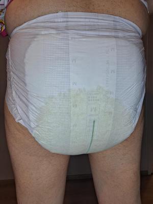 Diaper loser in wet and messy diapers