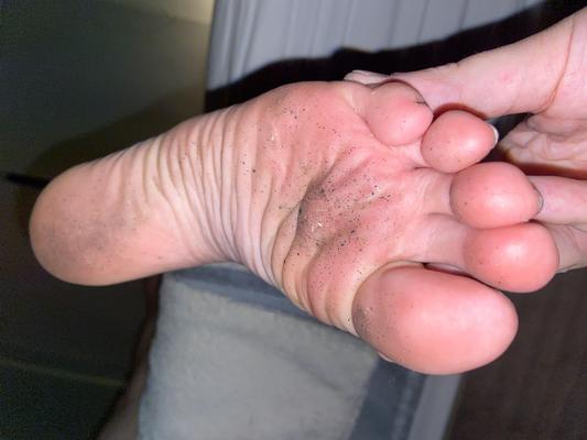 I yo dirty and smelly feet soles after a night out